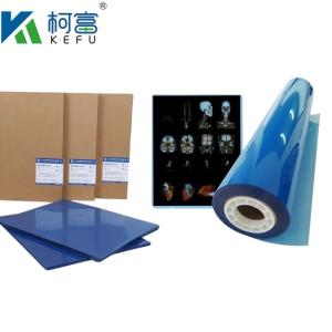 Wholesale Customized Size 35x43 Inkjet Blue Medical X Ray Film For Epson A4 PET Dry Blue Medical Laser Xray from china suppliers