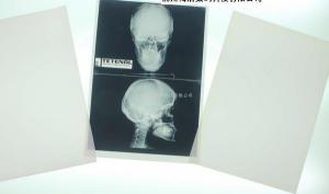 Wholesale Degradable White Base Xray Paper Medical Film For Laser Printer from china suppliers