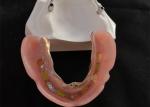 Titanium/Pure Titanium Dental Implant Bar for CAD CAM Digital Center