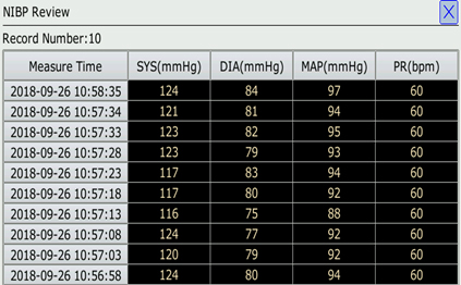 12.1 inch medical wireless multi-parameters vital signs monitor newtech criticare capnography patient monitor for hospit