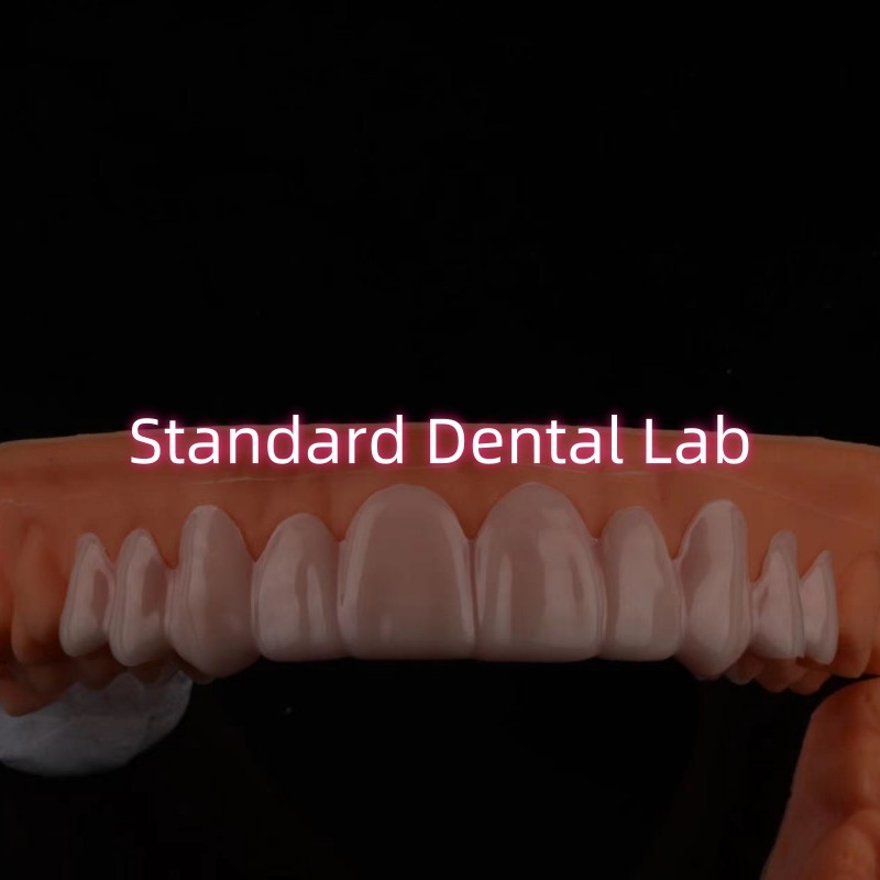 Dental Snap On Smile Veneers For Teeth Discolorations / Gaps