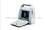 High Accuracy Portable Ophthalmic A B Scan Ultrasound Machine