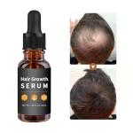 Anti Loss And Hair Regrowth Hair Oil Treatment With Natural Ginger Extract 30ml
