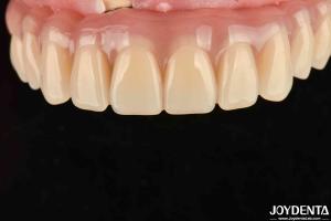Wholesale Fast Drying 5 Minutes Acrylic Teeth Finish For Dental Tooth Restoration from china suppliers