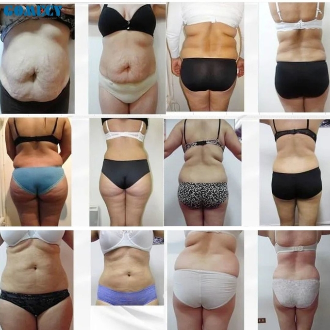 2025 Body Shape 6D Lipo Laser Slimming Machine Fats Removal 635 Slim Weight Loss