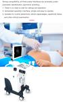 4 Probe Trolley 4D Color Doppler Ultrasound Scanner