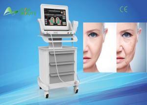 Wholesale 2016 hottest selling face lifting ultrasound hifu machine from china suppliers