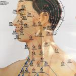 3pcs Meridian Acupuncture Chart ISO Acupuncture Culture