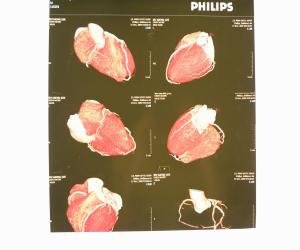 Wholesale Waterproof X Ray Diagnostic Imaging Medical Paper For Laser Printers KND-K from china suppliers
