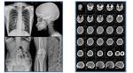 Silver Halide Blue Inkjet Film For Medical Imaging