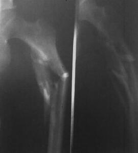 Wholesale 11 x 14inch Medical X-ray Film Digital For AGFA / Fuji Printer from china suppliers