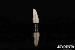 Zirconia Custom Abutments And Bars Dental Restorations For Individual Patient's