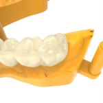 Dental 10 Ml Permanent Crown Materials with Flexible Flexibility and 5.5-7.3%