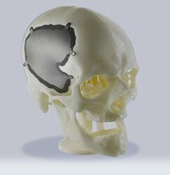 Professional SLS 3D Printing Service Customized Plastic Parts For Medical