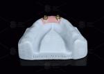 Titanium Locator Dental Attachments For Overdentures In Silver And Gold Finish