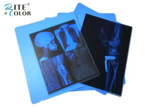 Wholesale Inkjet PET Medical Imaging Blue X Ray Film For Canon Pixma Printers from china suppliers