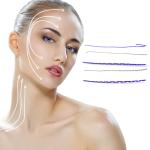 Korea Sterile Nose V Line Pdo Thread Lift For Skin Tightening