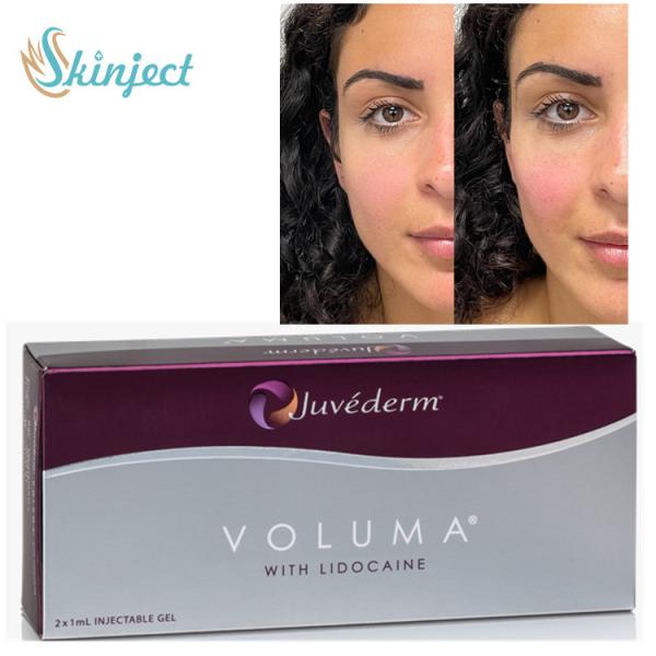 Juvederm Voluma Crosslinked Hyaluronic Acid Filler Long Lasting Face Pure Injectable