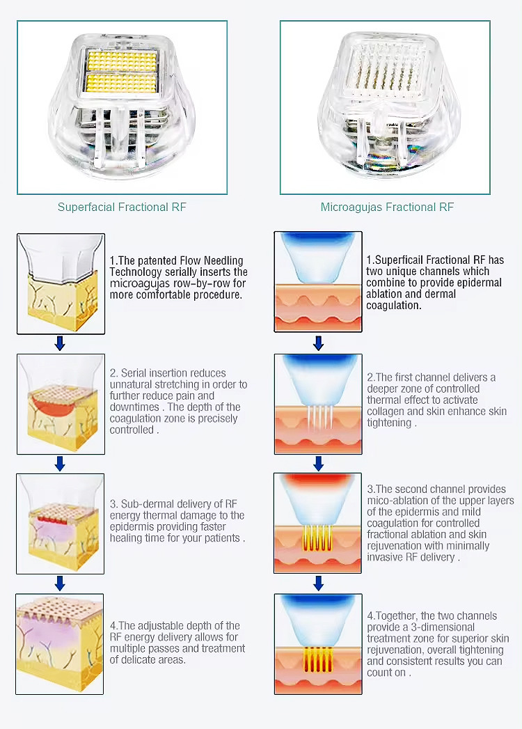 Skin Care Fractional Microneedle Vaccum Rf Machine For Skin Rejuvenation