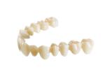 porcelain bridge Strong non-irritating Comfortable Strong Wear Resistance