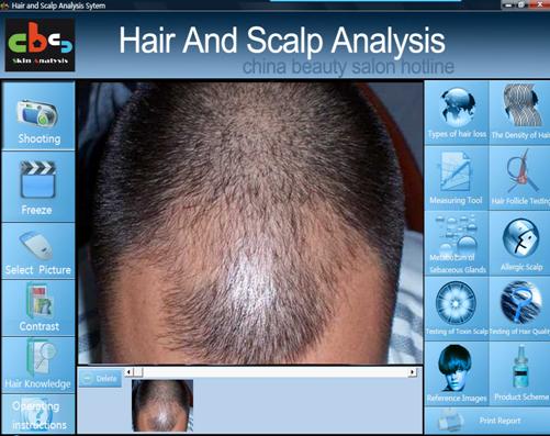 Hair Analyzer Machine with Certification spa/clinic/salon use