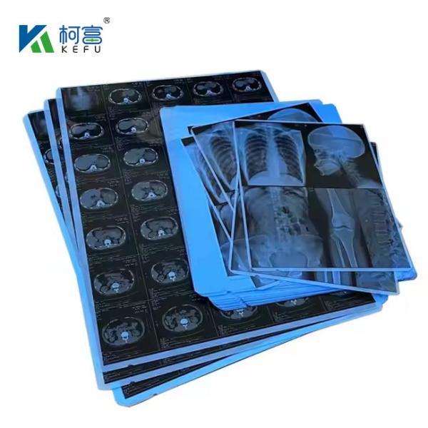 Blue PET Based X Ray Thermal / Inkjet Film Medical Images For Clinic And