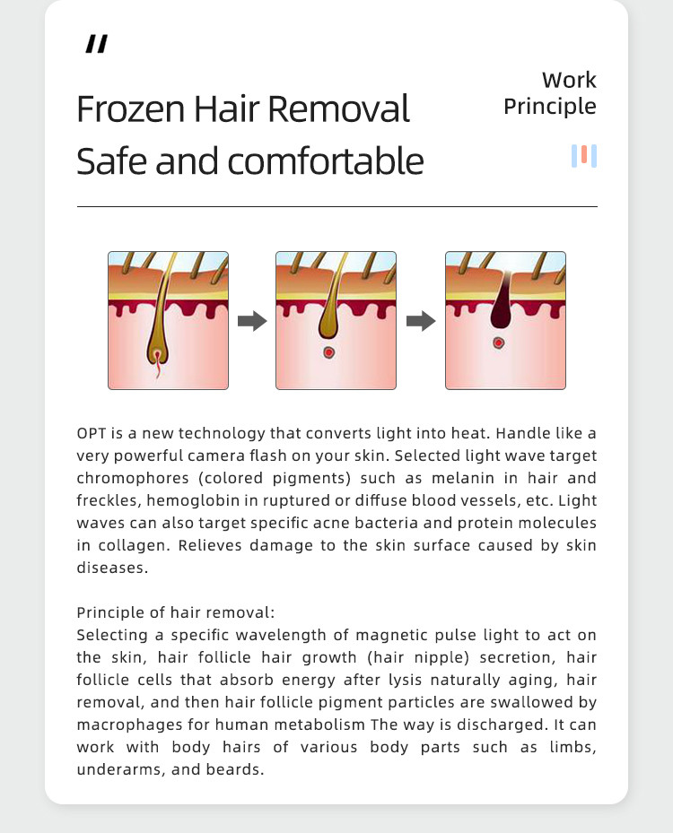 2 In 1 Q Switch nd yag ipl Freckle Remover Laser Yag Opt Shr Hair Removal Appliances