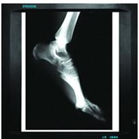 Wholesale agfa Dry Digital X ray Film For Medical , CE / SFDA / ISO 13485 from china suppliers