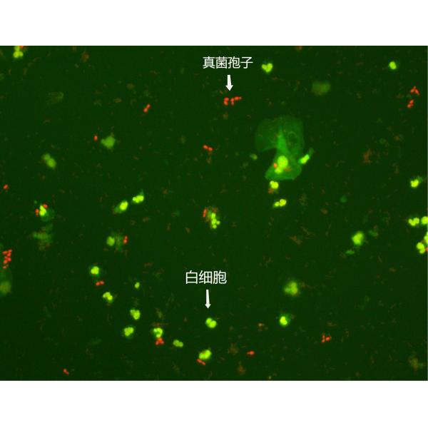 100Tests/Kit Immunofluorescence Stain For Genital Secretion (I)