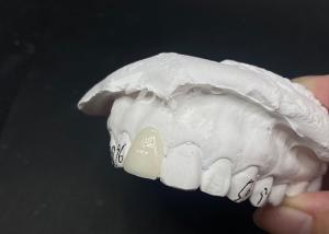Wholesale Translucent Custom Dental Veneers Fast and Effective Solutions for Long-Lasting Smile from china suppliers