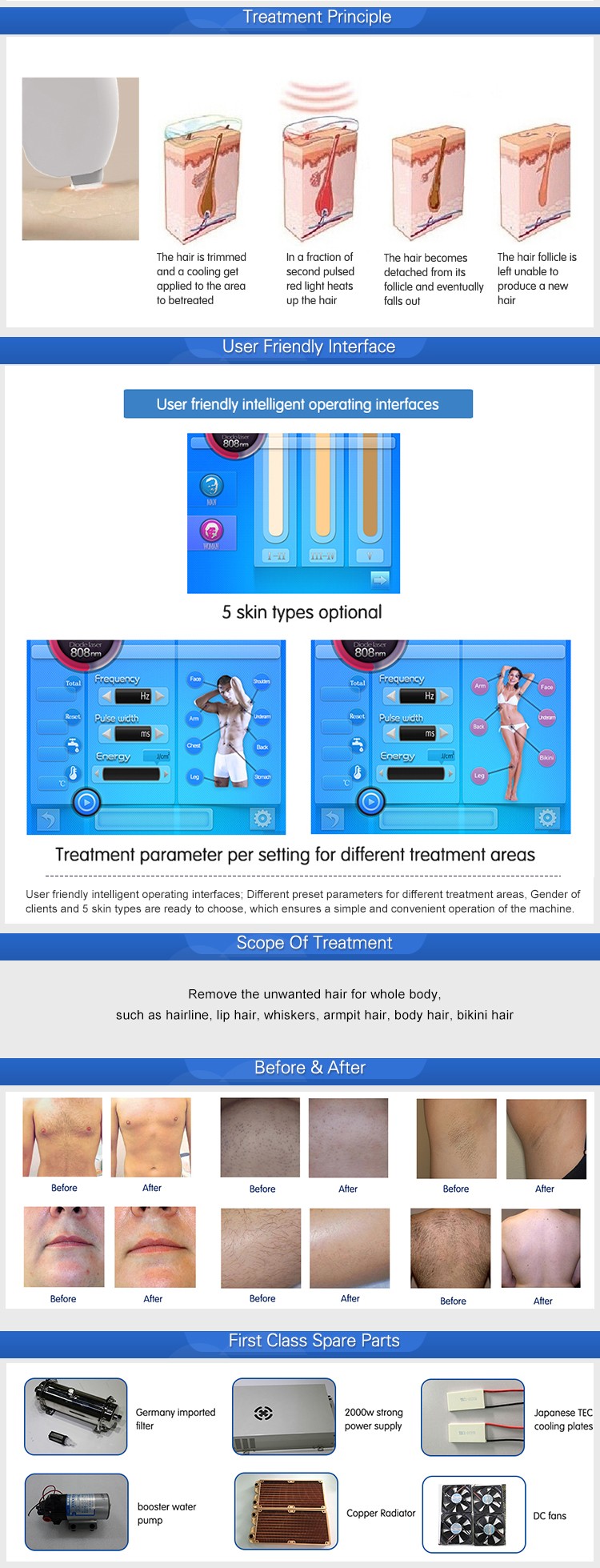 Best 808nm diode laser hair removal machine for beauty salon ＆beauty clinic
