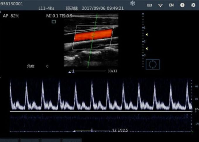 Color Doppler Ultrasound Probe Handheld Ultrasound Device For Mobilephone / PC