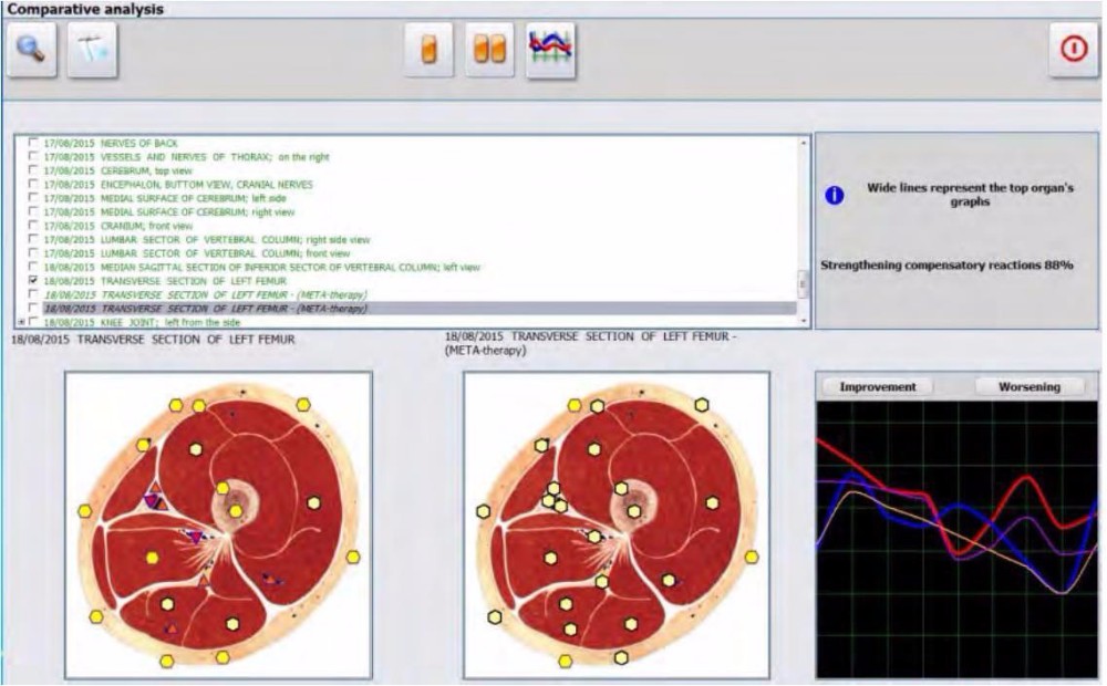 Metatron hunter 4025 with german software
