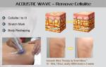 Shock wave therapy equipment home use medical smart-wave for diabetic foot
