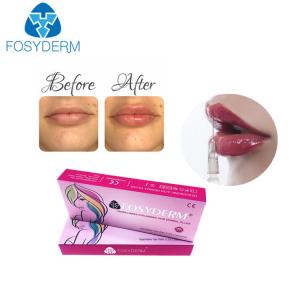 Wholesale 1ml hyaluronic acid lip fillers Derm Lip Enhancement Injection For Women from china suppliers