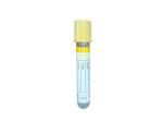 Hospital Plastic Glass SST Tube Medical Serum Separating Gel Clot Blood