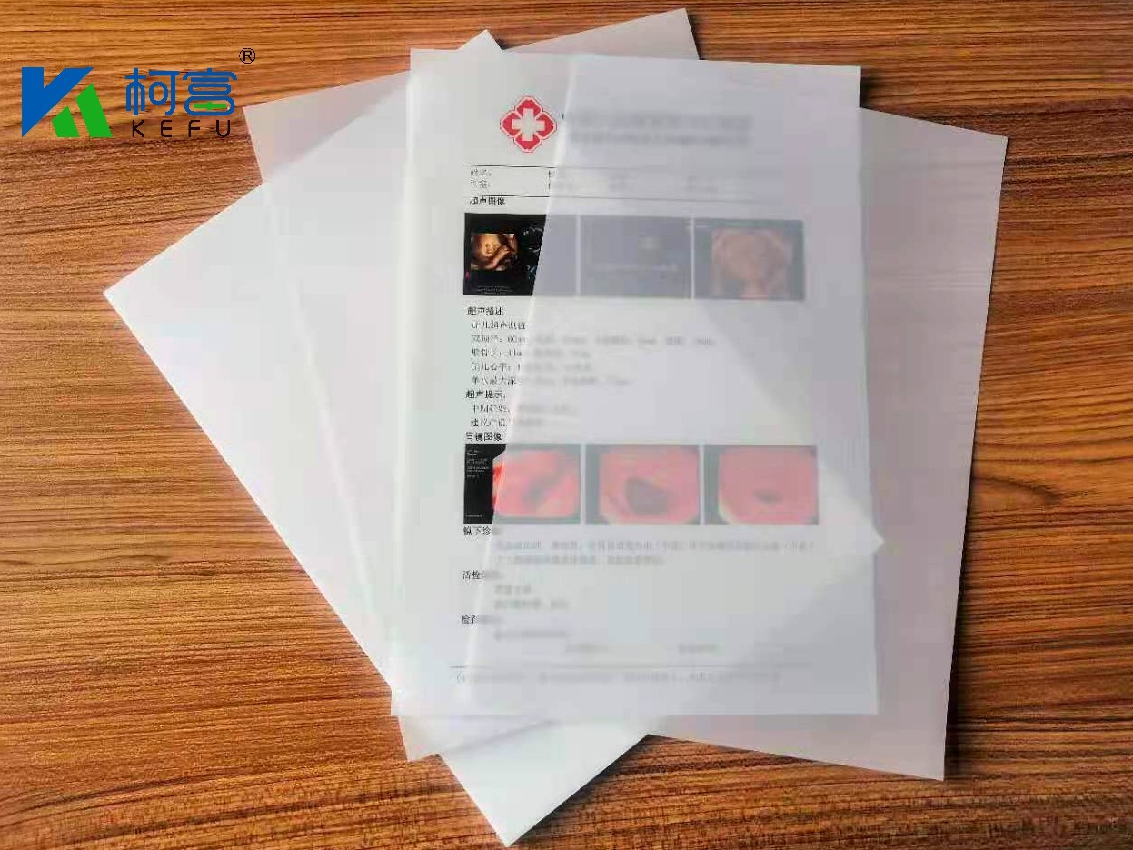 PET Smooth Surface Medical Dry Film With Haze ≤20% And Minimum Transmission Density ＜0.26 D