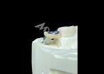 Dental Implant Crown With Titanium Abutment And Porcelain-Fused-to-Metal PFM