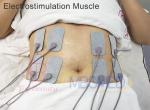 Indiba Tecar Therapy Ems Muscle Stimulator Diatermia Capacitiva Machine