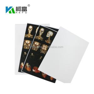 Wholesale A3 A4 Medical Waterproof Inkjet Film CT CR MR DR Digital X Ray Film from china suppliers