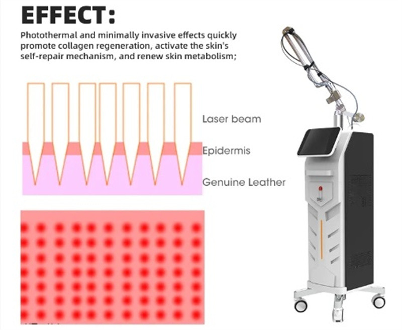 5MJ Fractional Co2 Laser Machine Wrinkle Removal Acne Removal