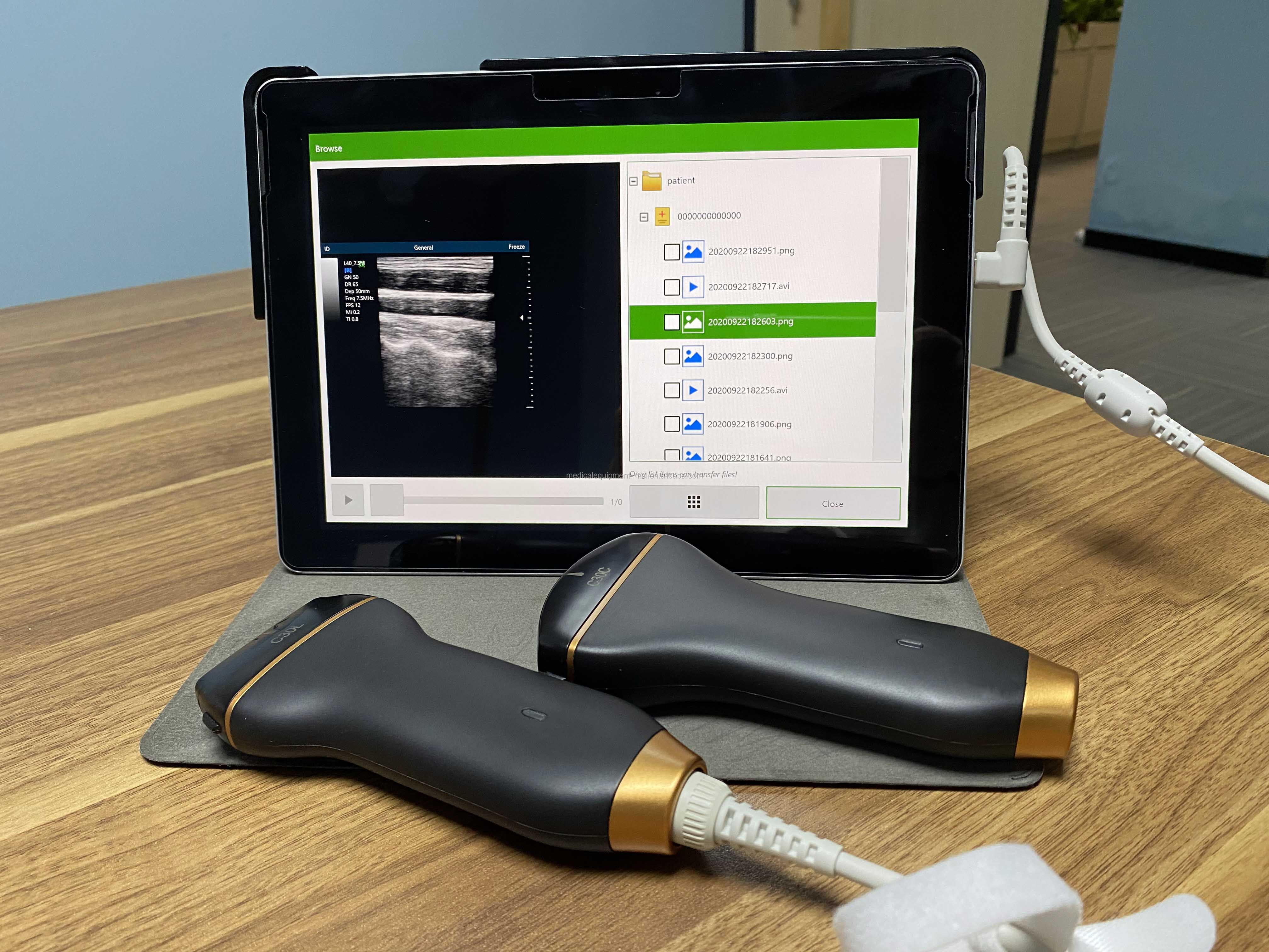 Mobile Smart USB Color Doppler Ultrasound Probe For Laptop