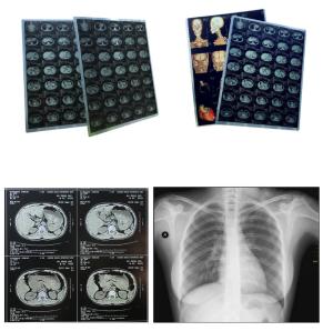 Wholesale Sheet Blue Xray Film Inkjet Medical Dry Film Clear Image from china suppliers