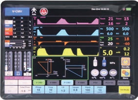 Rise Time Ventilator Parameter Range Anesthesia Ventilator Machine for Various Medical Institutions and Operating Rooms V-T Oscillogram