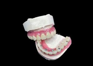 Wholesale Zirconia Dental Implant Crown Bridge All On 6 For Missing Teeth Replacement from china suppliers