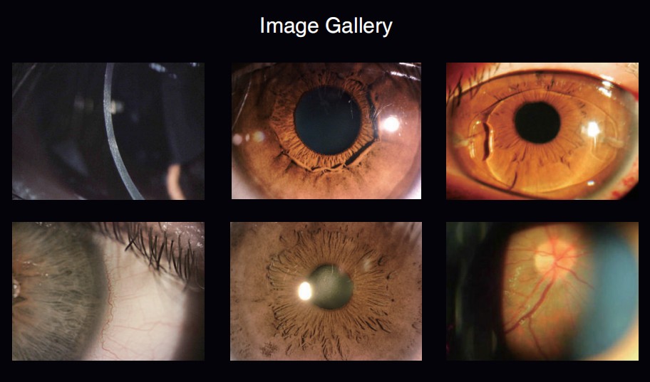 factory price led slit lamp microscope/slit lamp digital/digital portable slit lamp
