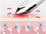 professional manufacturer eye wrinkle remover eraser facial massage with rf and