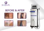 Skin Tightening Lady Hair Removal Machine Ipl Hair Removal System Ce Approval