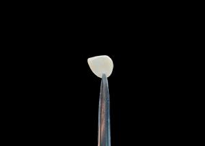 Wholesale Precision 0.2-0.5mm EMAX Cosmetic Teeth Veneers Natural Looking Chemical Bonding from china suppliers
