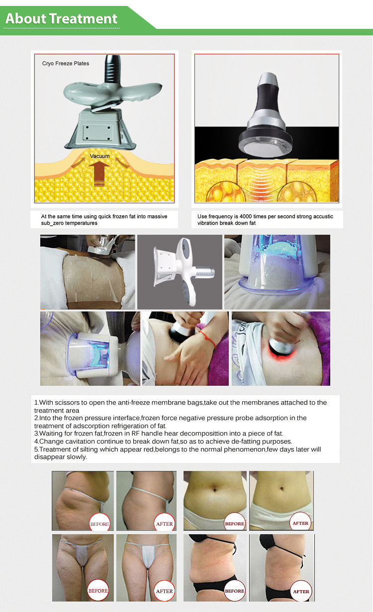 6 In 1 Cryolipolysis Fat Freezing Machine For Fat Slimming 2200W